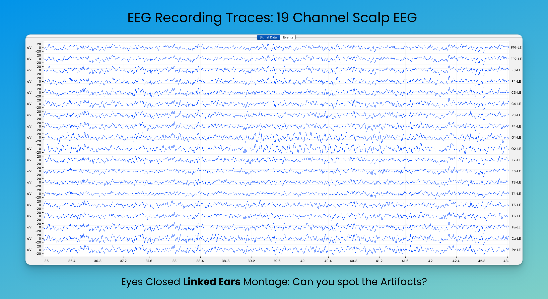 0a2625741cae487b74460082a52c0b07
