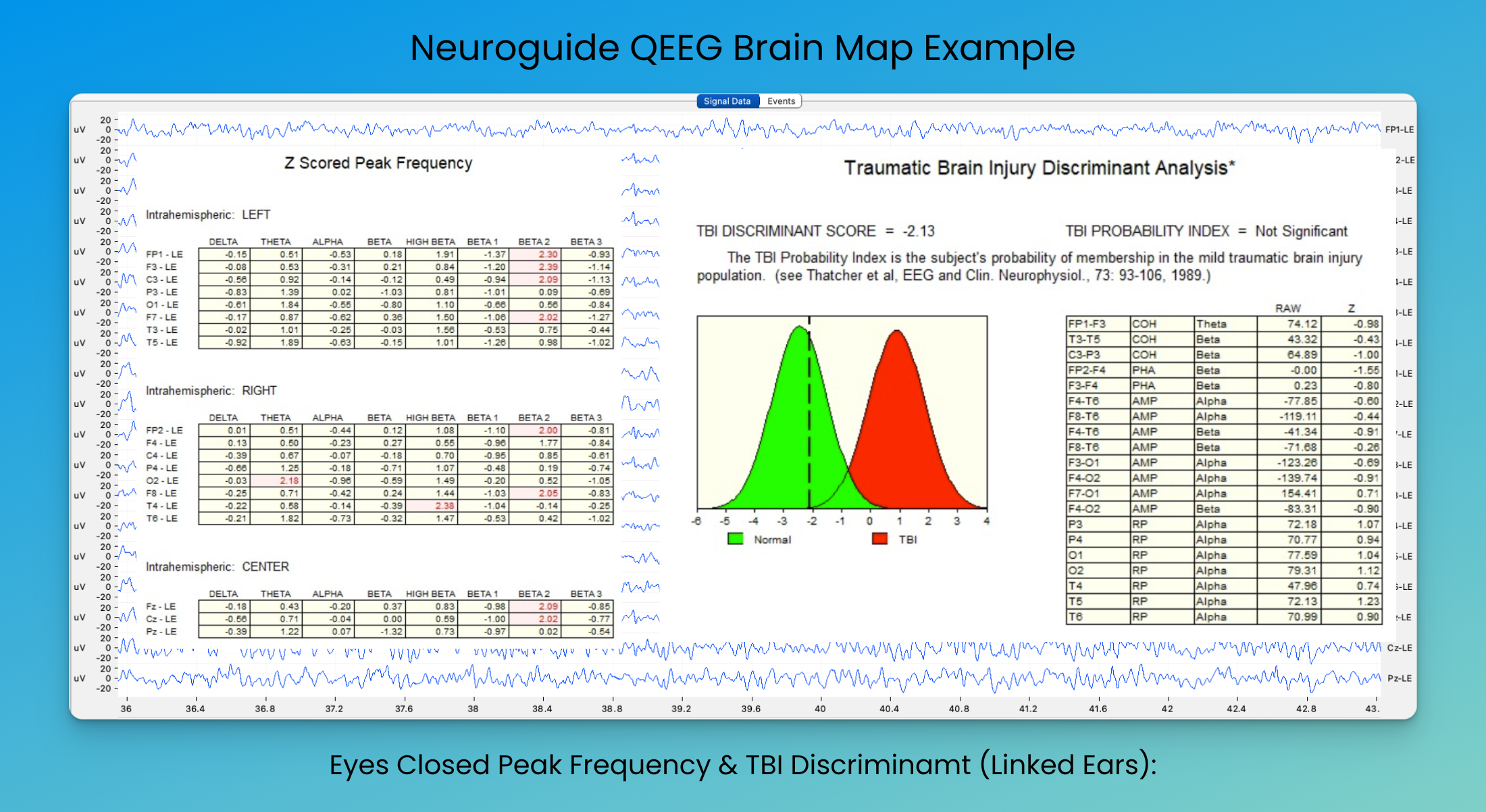 69fd192474e3eec05ece922a9a389f2b