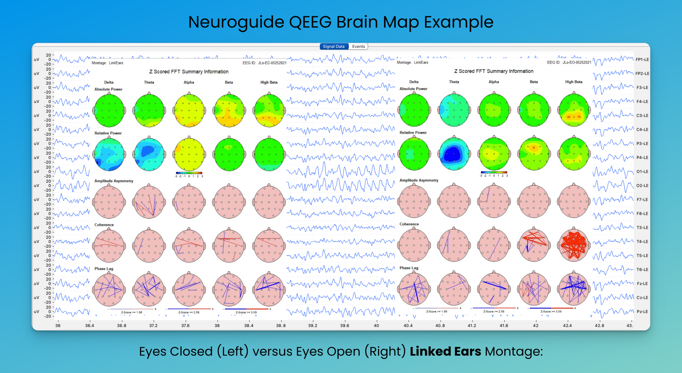 e1a10e5a5ed1efde67b2496182c0c4fd
