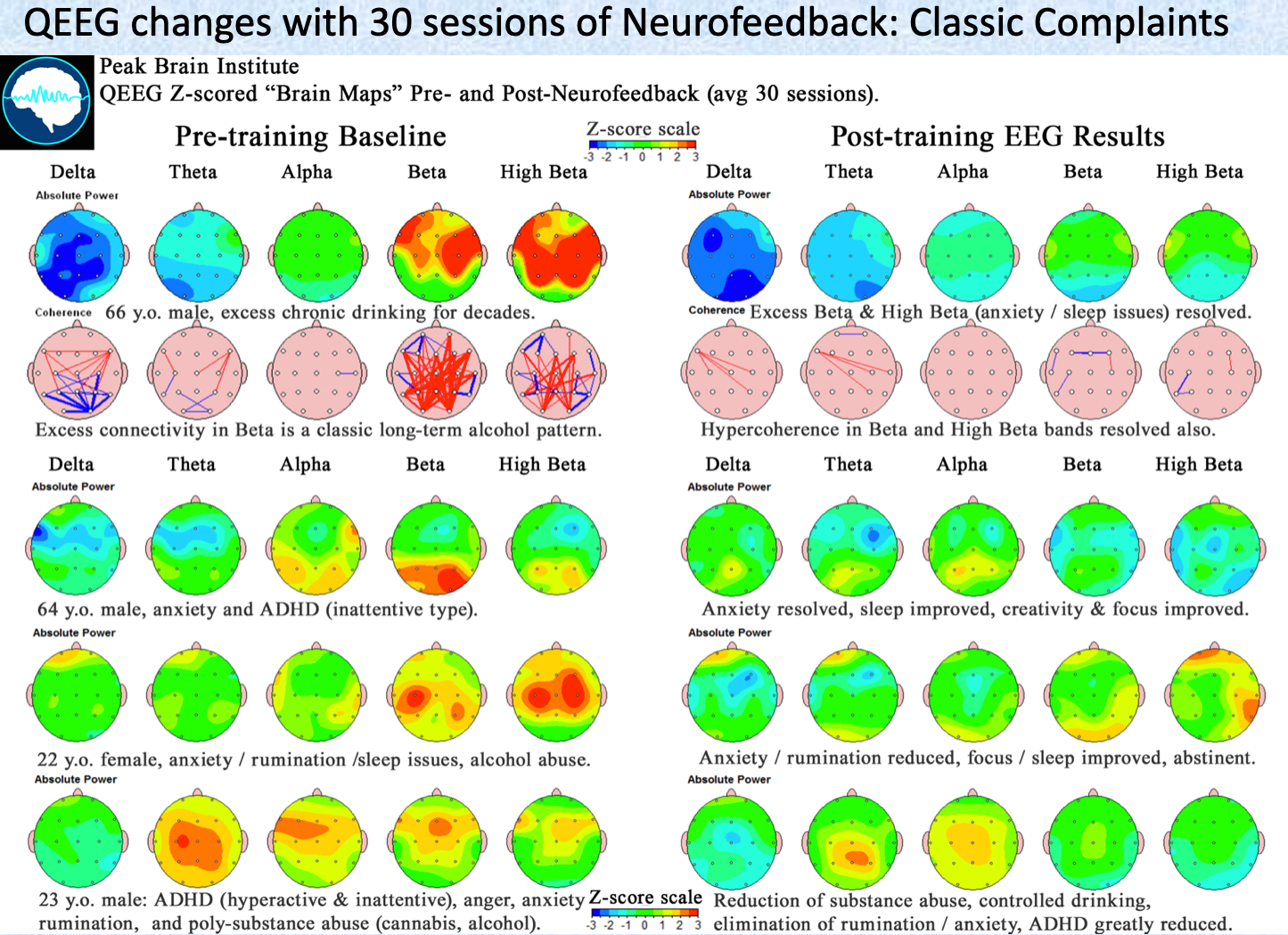 Neurofeedback