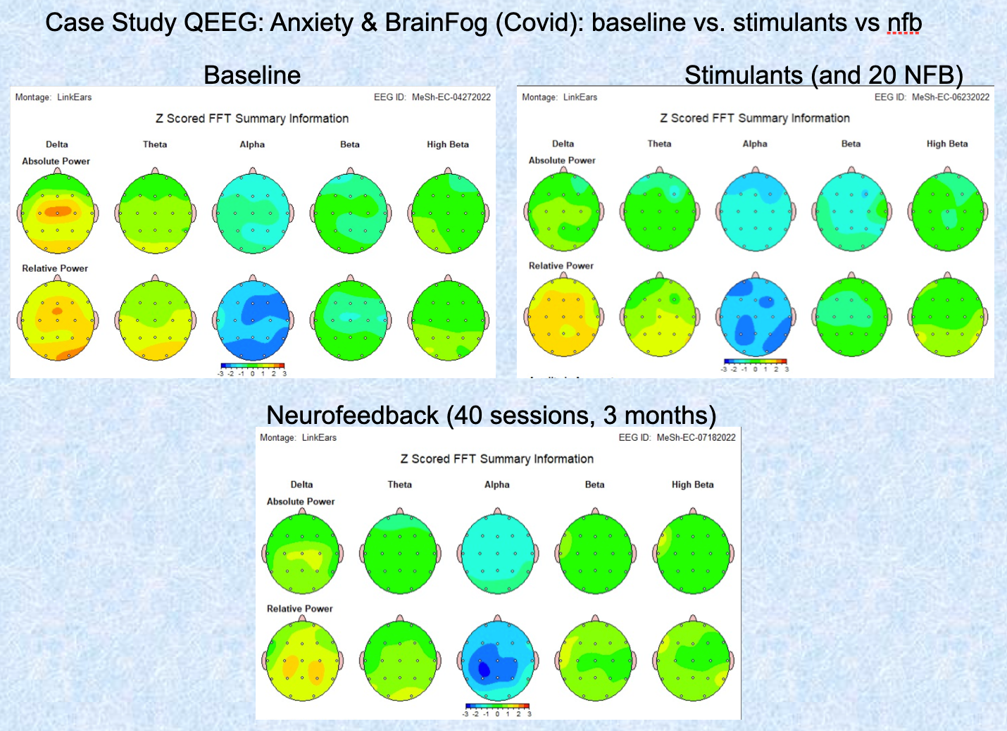 Case Study QEEG